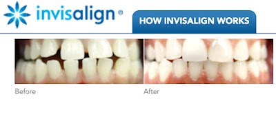 Estrella Dental Clinic- Malabon City