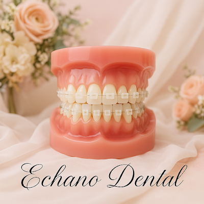 Echano Dental Clinic - Pasig - LasPinas - Quezon City