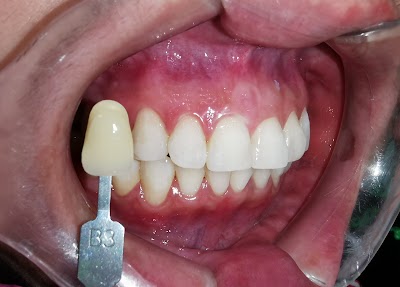 Clinica Dental Albano