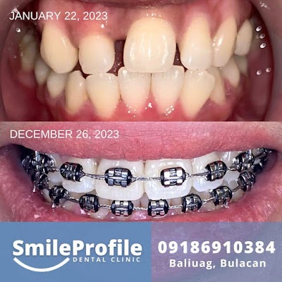 SmileProfile Dental Clinic