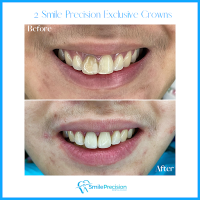 Smile Precision Dental Clinic - Pampanga Dentist